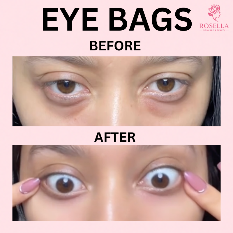 Rosella™ Korean Collagen Eye Patches