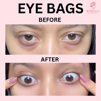 Rosella™ Korean Collagen Eye Patches